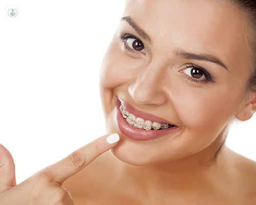 como-actuan-los-brackets