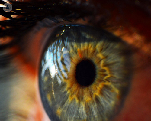 trasplante-total-de-cornea