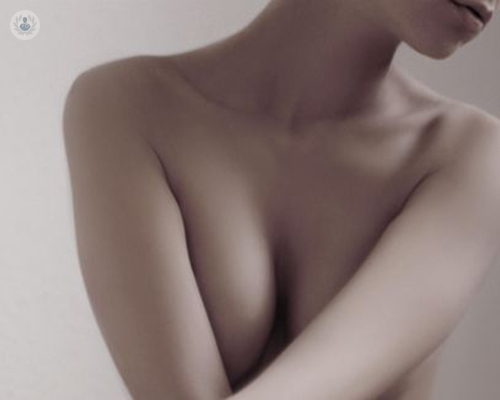 La mastopexia para la elevación de mamas