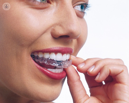invisalign-mujer-ortodoncia