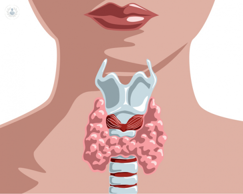 Cirugía para la tiroides