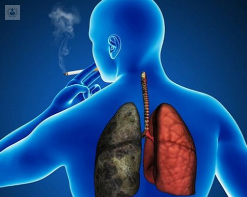 EPOC: Cirugía de Reducción de Volumen Pulmonar