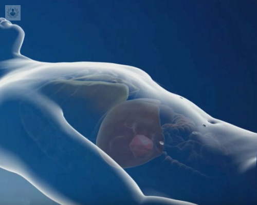 cirugia-laparoscopica-articulos