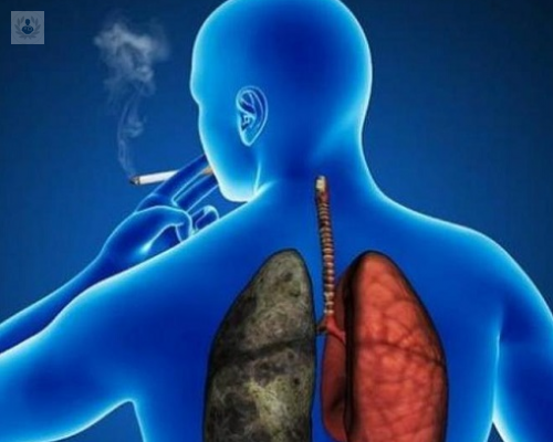 Principal factor del cáncer de pulmón: Tabaco