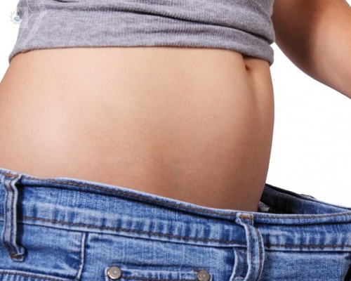 cirugia-bariatrica-complicaciones