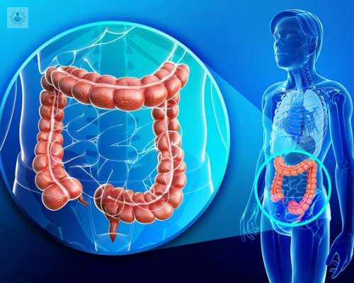 cancer-colorrectal-tratamiento