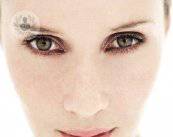 mesoterapia-facial