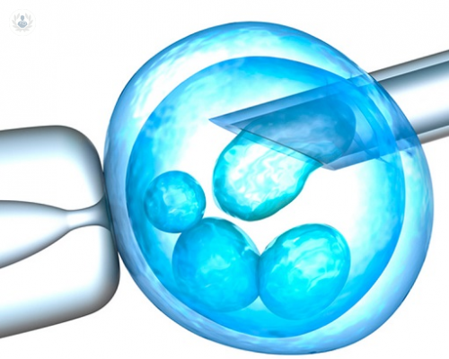 diagnostico-genetico-preimplantacional-fallos