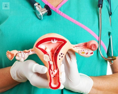 cancer-de-cuello-uterino-estadios