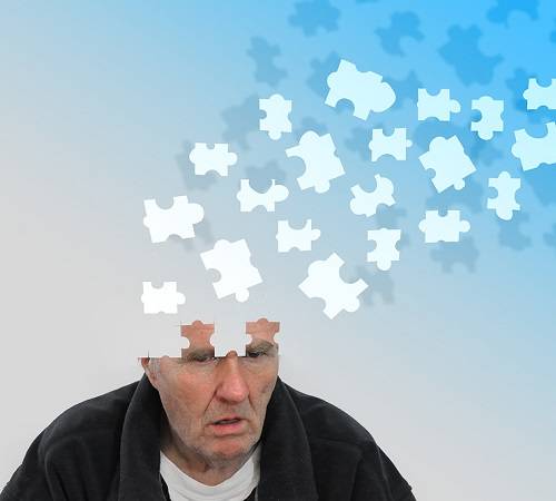 alzheimer sintomas