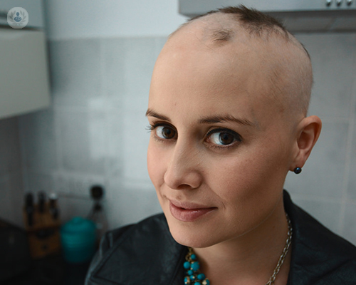 alopecia