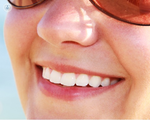 Tratamiento de la sonrisa con carillas de composite