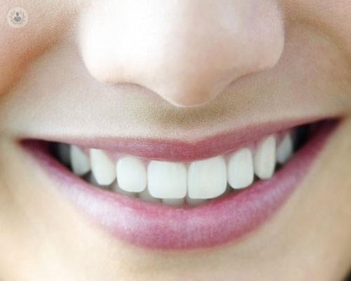 implantes-dentales-de-carga-inmediata imagen de artículo