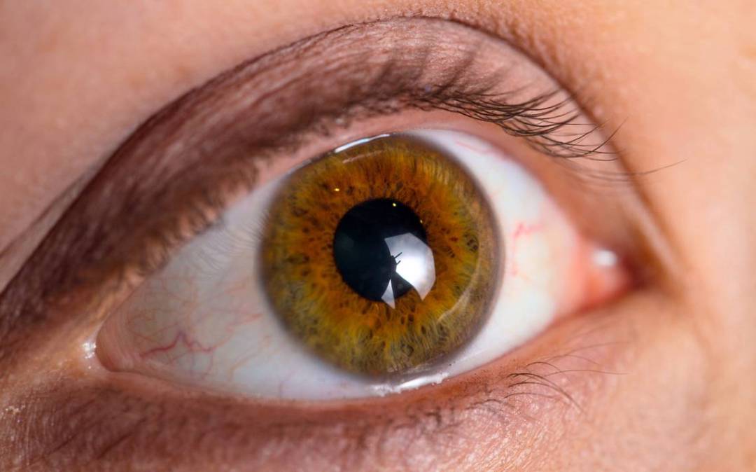 dia-mundial-del-glaucoma imagen de artículo