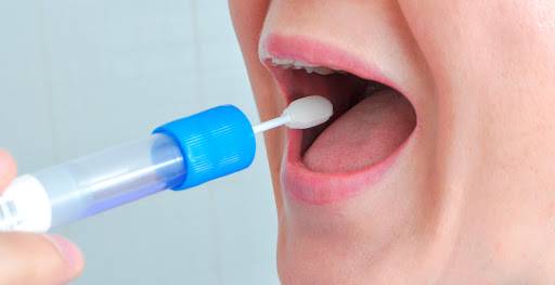 hisopados-bucales-prueba-para-detectar-coronavirus imagen de artículo