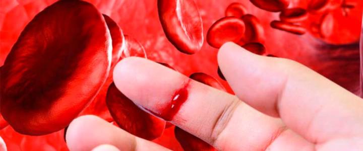 signos-de-alerta-de-la-hemofilia imagen de artículo