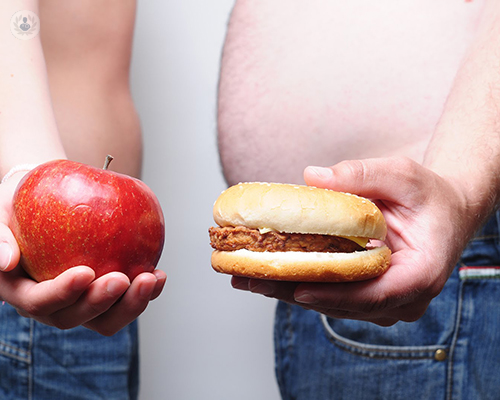 La cirugía de la obesidad elimina la diabetes tipo II en el 75% de los casos