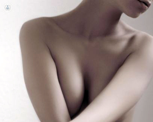 prevenir-el-cancer-de-mama