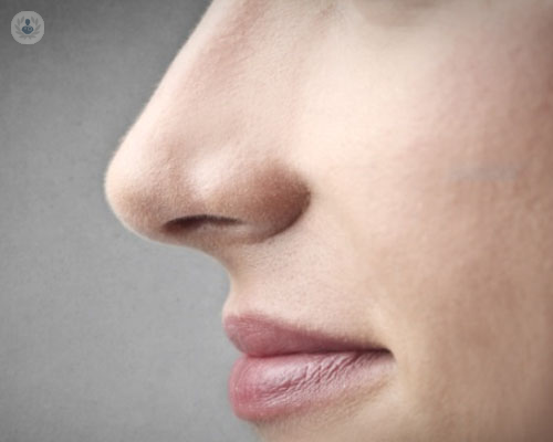 rinoplastia