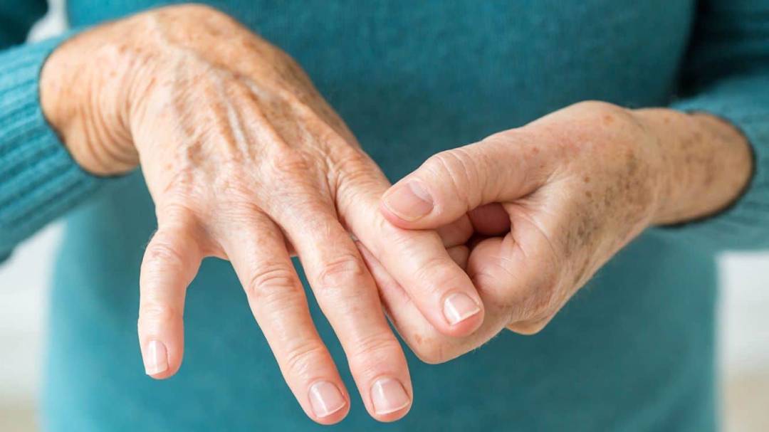Aprender a vivir con Artritis Reumatoide