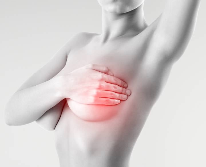 cancer-de-mama-inflamatorio imagen de artículo