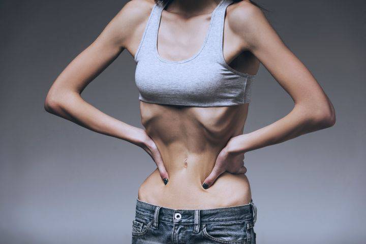 tratamiento-para-pacientes-con-anorexia-nerviosa imagen de artículo