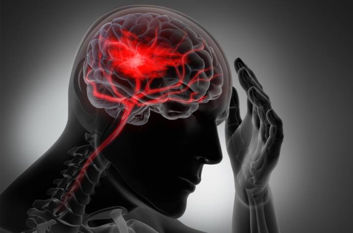 ictus-una-causa-de-discapacidad imagen de artículo