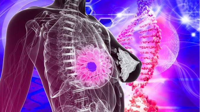 cancer-de-mama-estrategias-diagnosticas-y-terapeuticas imagen de artículo