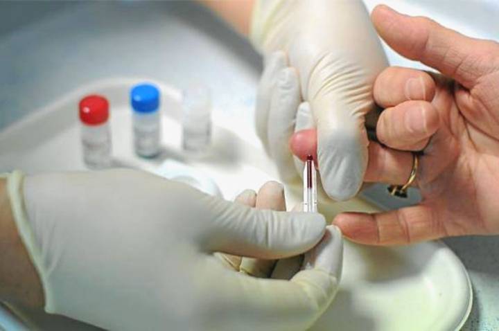 test-para-detectar-vih-sida-en-mar-del-plata imagen de artículo