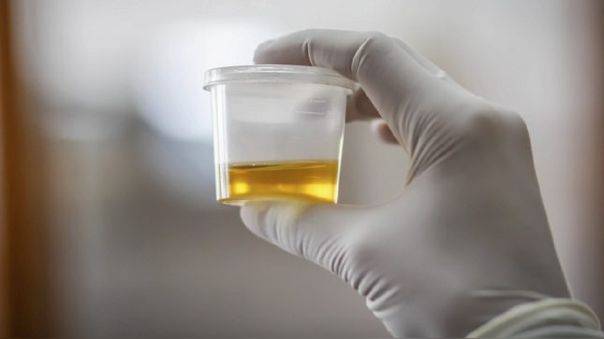 cambio-en-el-color-de-la-orina imagen de artículo