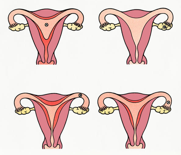 Ciclo Menstrual: ¿qué es y cuál es su duración?
