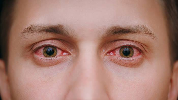 como-diferenciar-una-alergia-de-una-gripe imagen de artículo