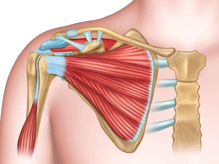 lesion-del-manguito-rotador-como-identificarla imagen de artículo