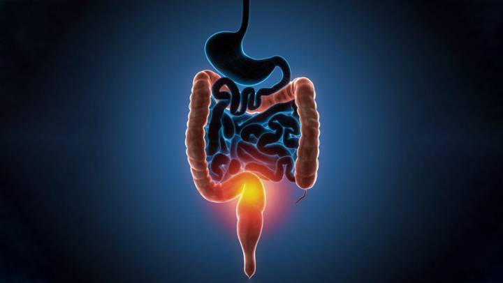 las-enfermedades-inflamatorias-intestinales-eii-en-tiempos-de-pandemia imagen de artículo