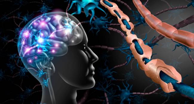 ¿Qué es la Esclerosis Múltiple y cómo detectarla?