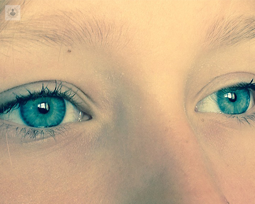 degeneracion-macular