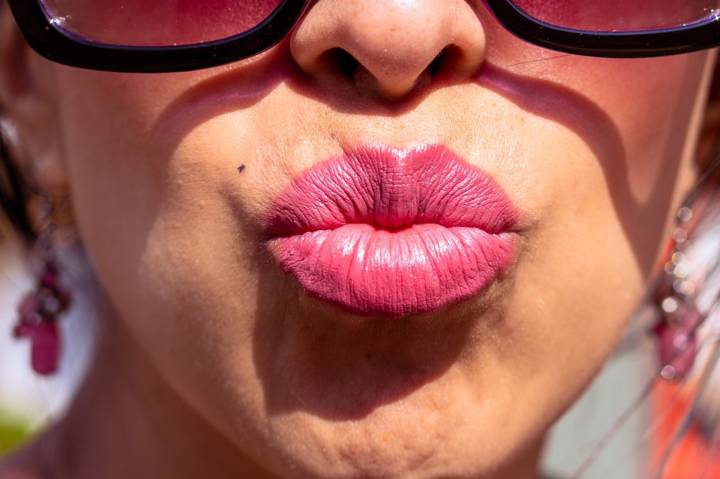 y-tu-tienes-arrugas-arriba-de-los-labios imagen de artículo