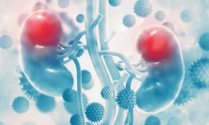 mentiras-sobre-el-cancer-de-rinon imagen de artículo