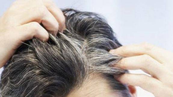 canas-por-que-salen-tipos-y-enfermedades-relacionadas imagen de artículo
