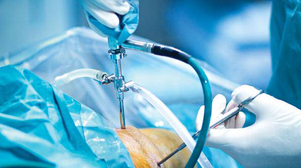 cirugia-de-columna-minimamente-invasiva imagen de artículo