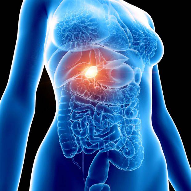 cirugia-de-la-vesicula-biliar-para-extraer-calculos imagen de artículo