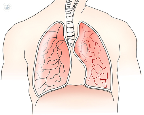 El nódulo pulmonar, el diagnóstico y sus causas 