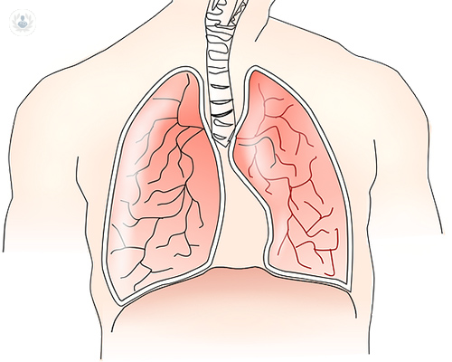 pulmones