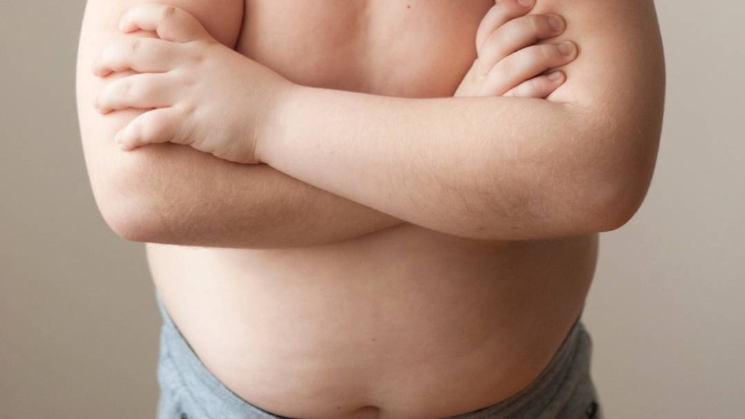 Cirugía de la Obesidad: beneficios, riesgos y complicaciones