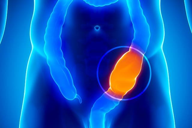 colon-y-recto-opciones-de-cirugia-de-enfermedad-colorrectal imagen de artículo