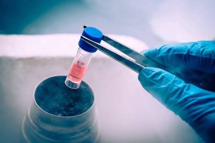 dudas-frecuentes-sobre-la-congelacion-de-ovulos imagen de artículo