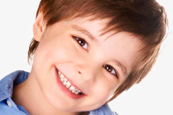 relacion-entre-bruxismo-y-autismo imagen de artículo