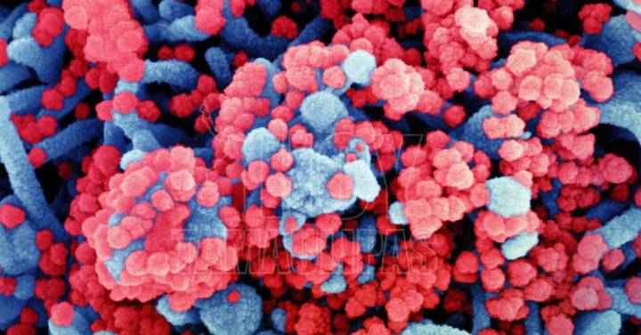 delta-y-omicron-se-descubre-variante-con-combinacion-de-estas-dos imagen de artículo