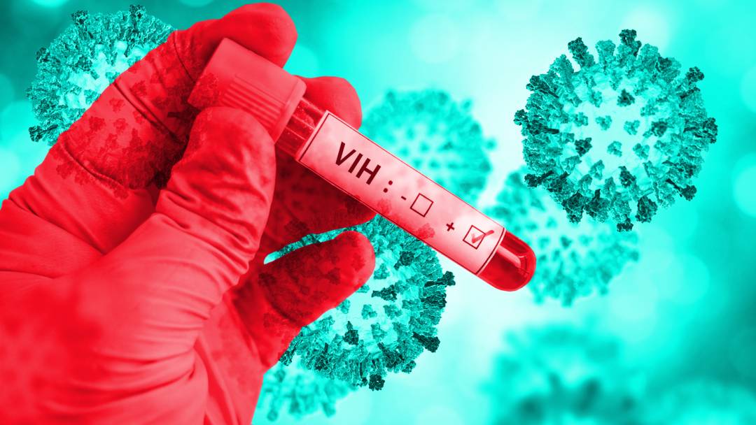 VIH, una enfermedad para toda la vida | Top Doctors