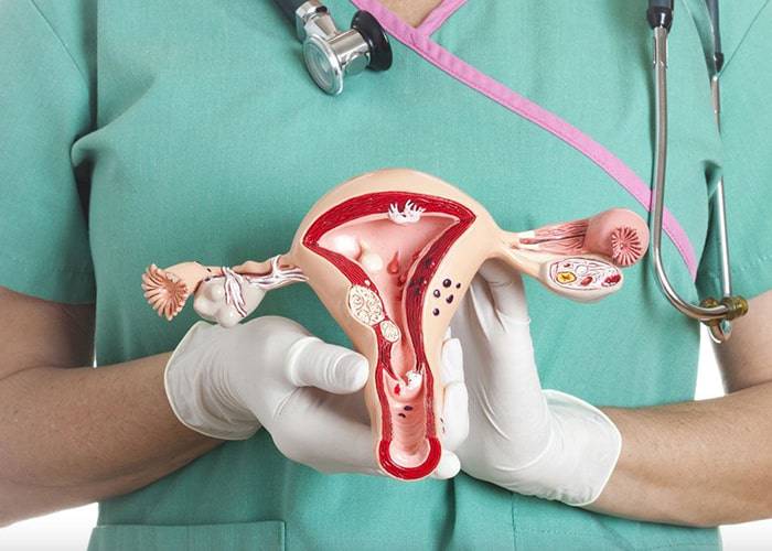 Síndrome de Ovarios Poliquísticos, lo que debes saber